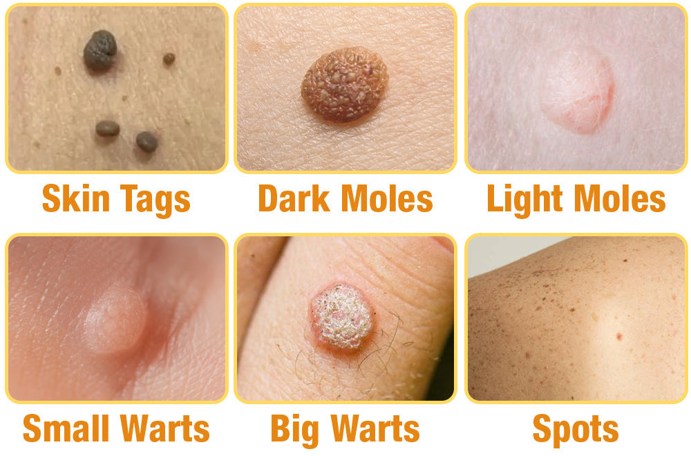 Bee Venom Treatment Spray