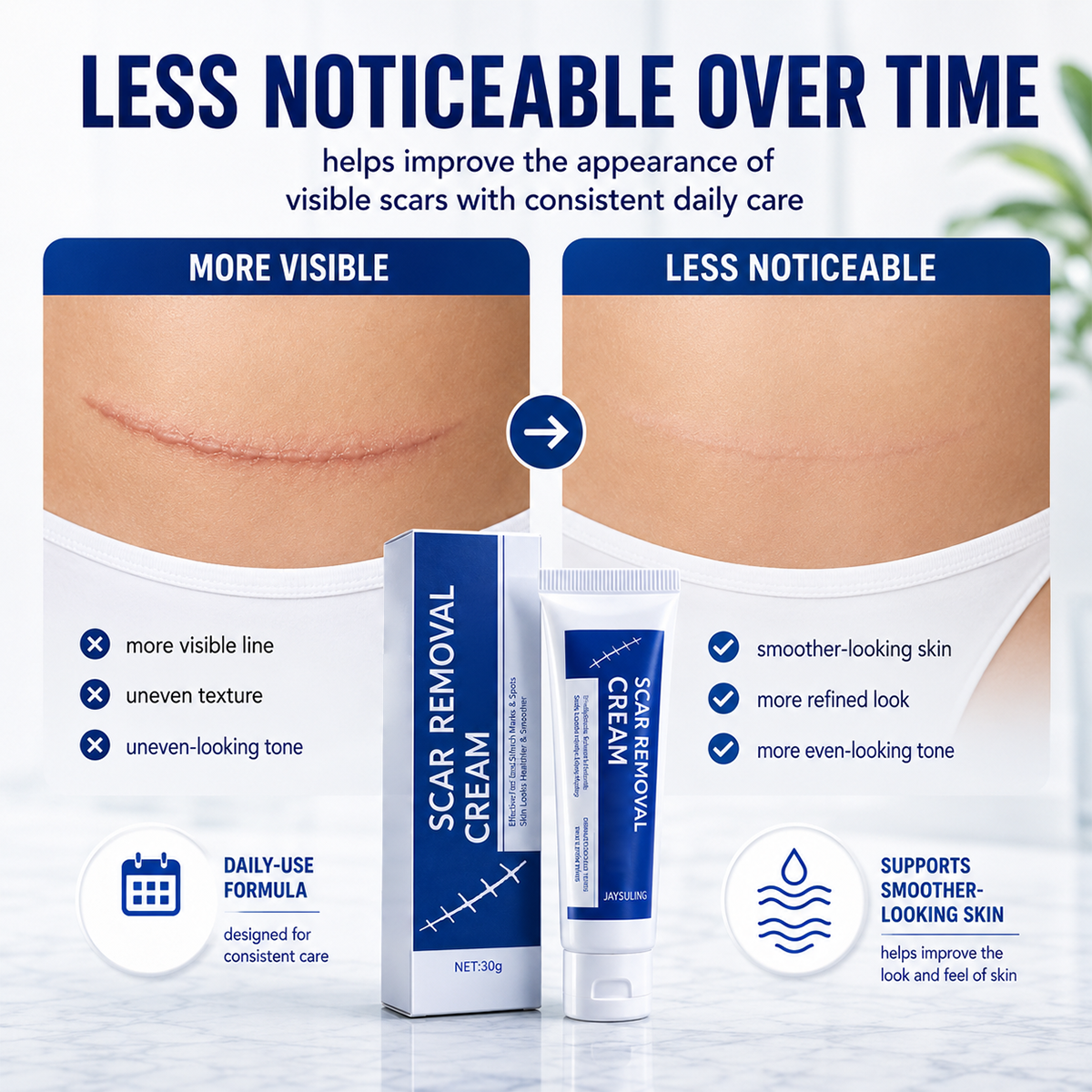 Scar Removal Cream- Great for all types of marks