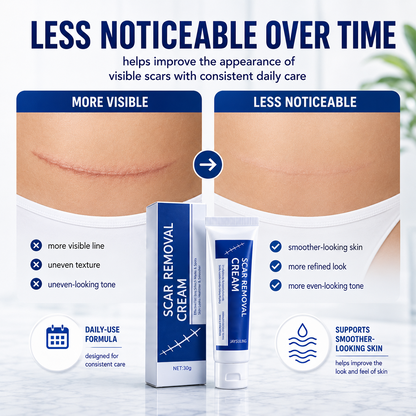 Scar Removal Cream- Great for all types of marks