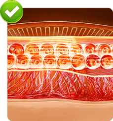 Muscle tension release