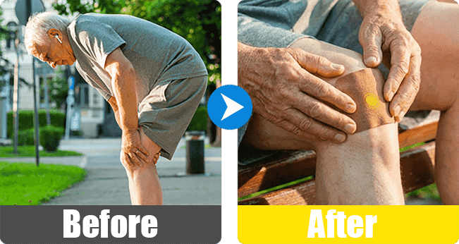 Knee before and after
