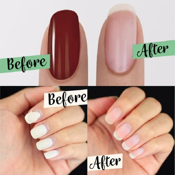 💅✨ Upgraded Magic Nail Polish Remover – Fast‑Acting, Gentle, Travel‑Ready 🌿